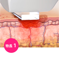 特長1:シミ・そばかす・くすみにしっかりアプローチ