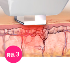 特長3:色むらをケアして透明感のあるお肌に