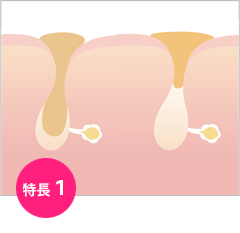 角質除去と皮脂コントロール