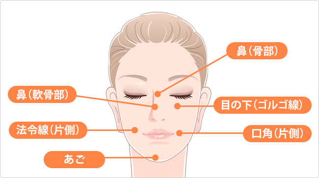 「シワ取り、鼻・あご形成」ヒアルロン酸集中ケア